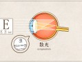 散光的矫正眼镜是什么，散光的矫正眼镜是什么意思