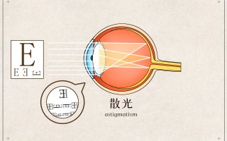 散光的矫正眼镜是什么，散光的矫正眼镜是什么意思