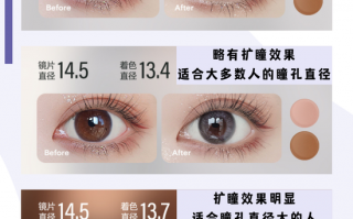 隐形直径怎么选，隐形直径怎么选尺寸